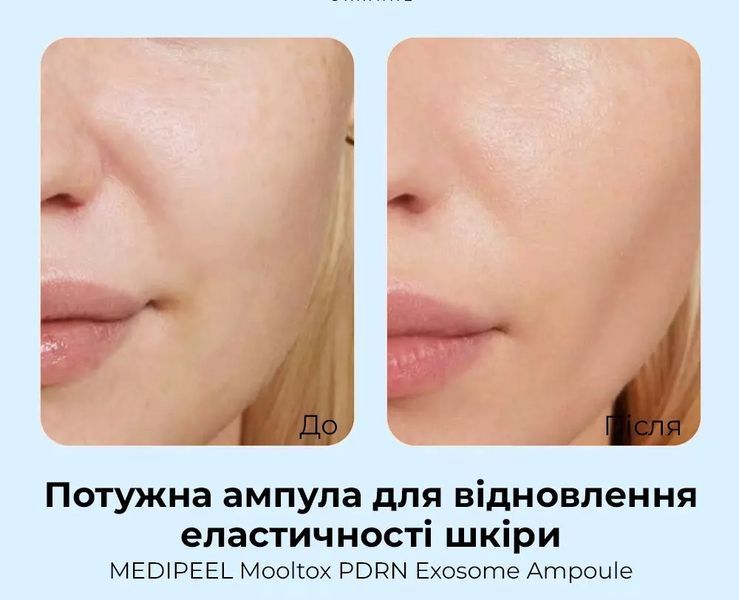 Сироватка для регенерації та відновлення еластичності шкіри Medi-Peel Mooltox PDRN Exosome Ampoule, 50ml 2572514983 фото