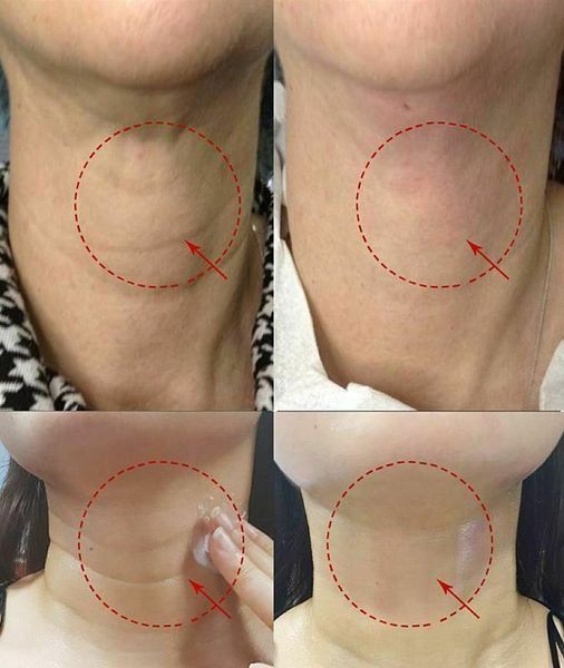 Підтягувальний крем для шиї Medi-Peel Premium Collagen Naite Thread Neck Cream 2.0 100ml 1437210585 фото