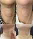 Підтягувальний крем для шиї Medi-Peel Premium Collagen Naite Thread Neck Cream 2.0 100ml 1437210585 фото 3