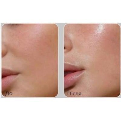 Лифтинг-эссенция для лица с пептидами Medi-Peel Peptide 9 Volume Lifting All-In-One Essence PRO, 100ml 2392813006 фото