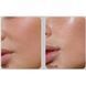Лифтинг-эссенция для лица с пептидами Medi-Peel Peptide 9 Volume Lifting All-In-One Essence PRO, 100ml 2392813006 фото 2