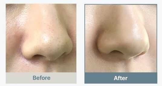 Зволожувальна паста 4в1 для вмивання обличчя з рисом Arencia Fresh Blue Hyssop Rice Mochi Cleanser, 120g AR-001 фото