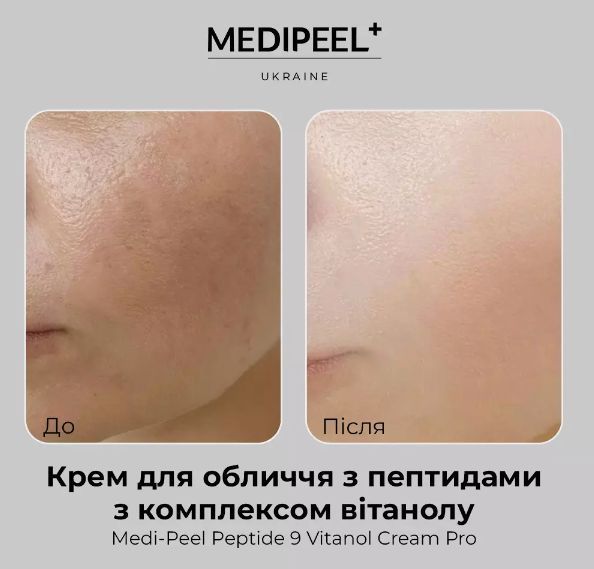 Крем Medi Peel Peptide 9 Vitanol Cream Pro, 50 ml 2138887022 фото