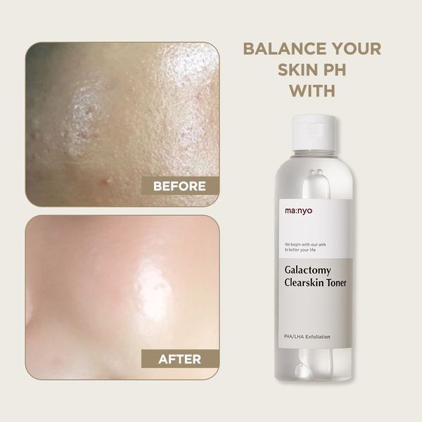 Тонер очисний з галактомісистом і кислотами Manyo Galactomy Clearskin Toner 210 ml 1519466234 фото