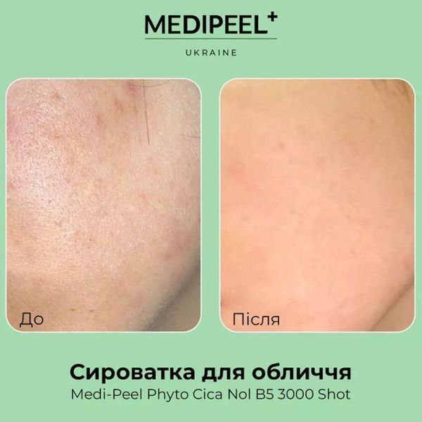 Сироватка-пілінг зі спікулами й екстрактом центели Medi-Peel Phyto Cica-nol B5 3,000 Shot Serum, 50ml 2515363841 фото